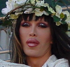 Pete Burns Biography