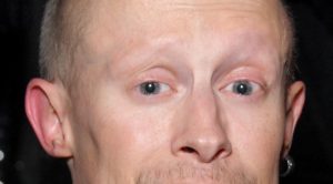 Verne Troyer