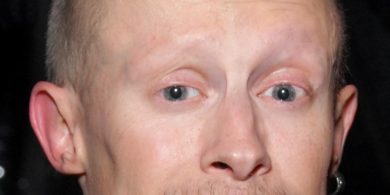 Verne Troyer