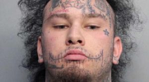 Stitches