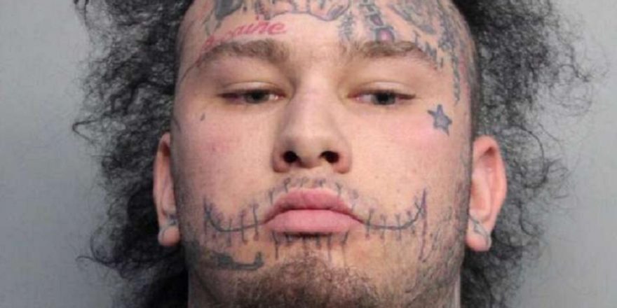 Stitches